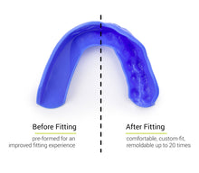 Load image into Gallery viewer, SISU 3D Custom Fit Mouthguard
